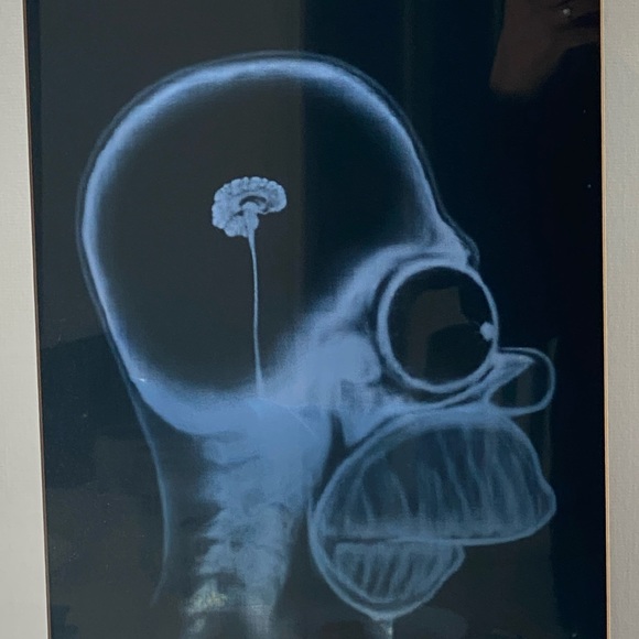 Homer Simpson XRay in picture frame - Picture 2 of 6